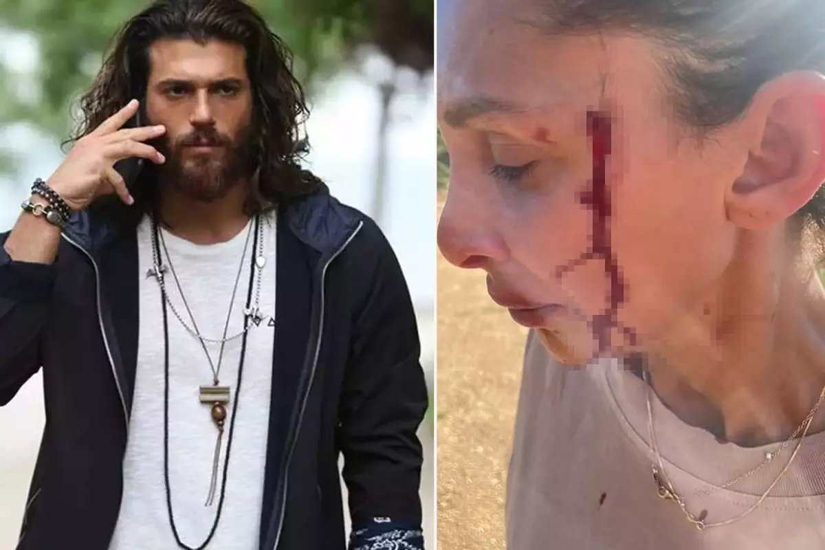Can Yaman’ın sevgilisi Sara Bluma şiddet gördüğünü açıkladı