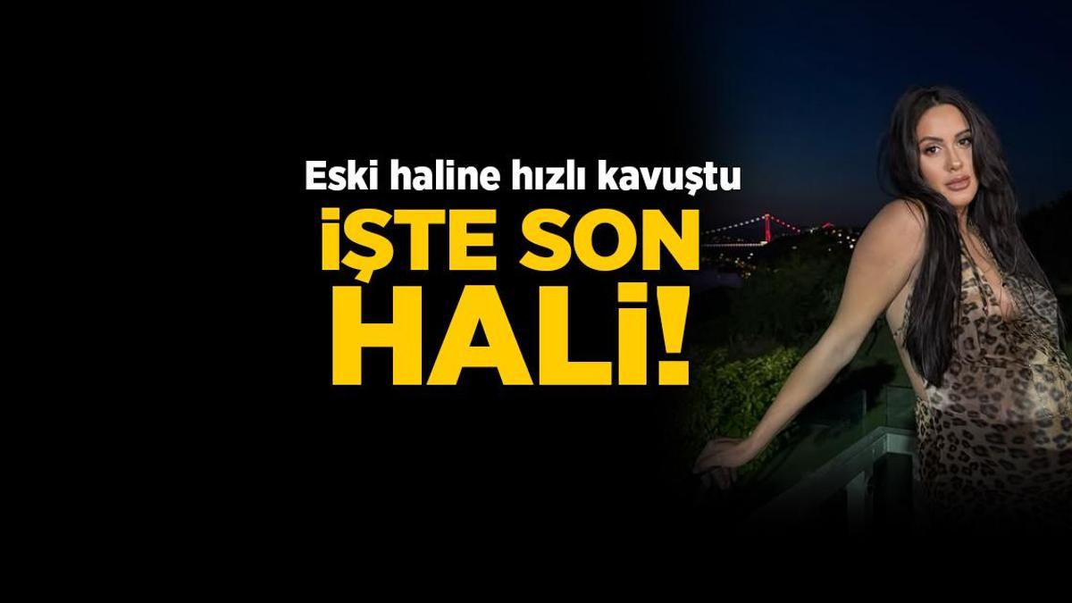 Doğum kilolarından süratli kurtuldu! Survivor Sahra eski formuna kavuştu: İşte son hali